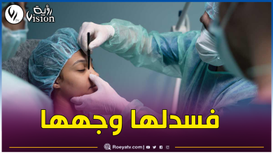 صورة العاصمة.. طبيب تجميل يُشوّه وجه فتاة قبل زفافها بأيام