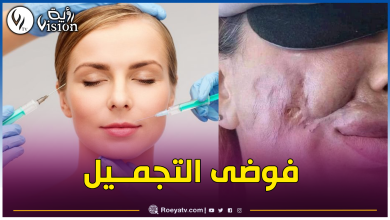 صورة حماية المستهلك لرؤية: ما يحدث في صالونات الحلاقة خطير جدا وحالات التشويه في تزايد مخيف