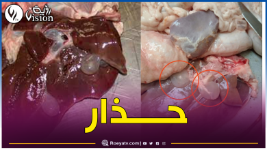 صورة وزارة الصحة تُنبه: الكيس المائي خطر على الأضحية وصاحبها